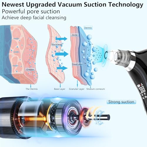 SJIE Blackhead Remover Vacuum Pore Cleaner with Hot & Cold Compress Q943275