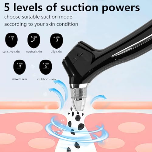SJIE Blackhead Remover Vacuum Pore Cleaner with Hot & Cold Compress Q943275